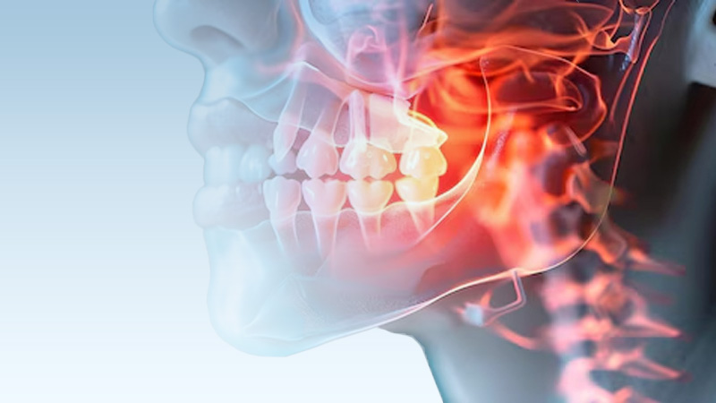 T%MJ-Airways - The Center For Dental Healing TMJ/Airway Dentistry at The Center for Dental Healing